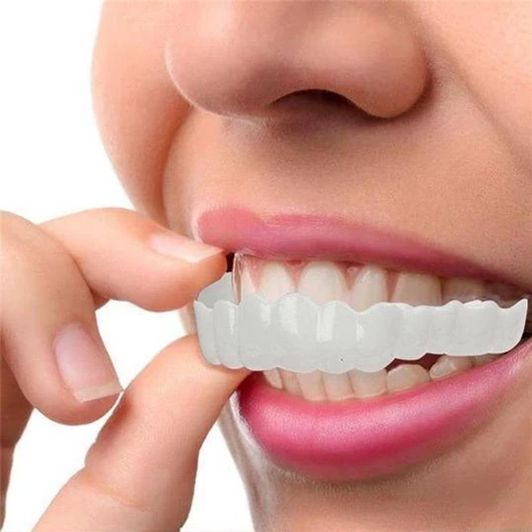 Perfect Smile Snap-On Braces